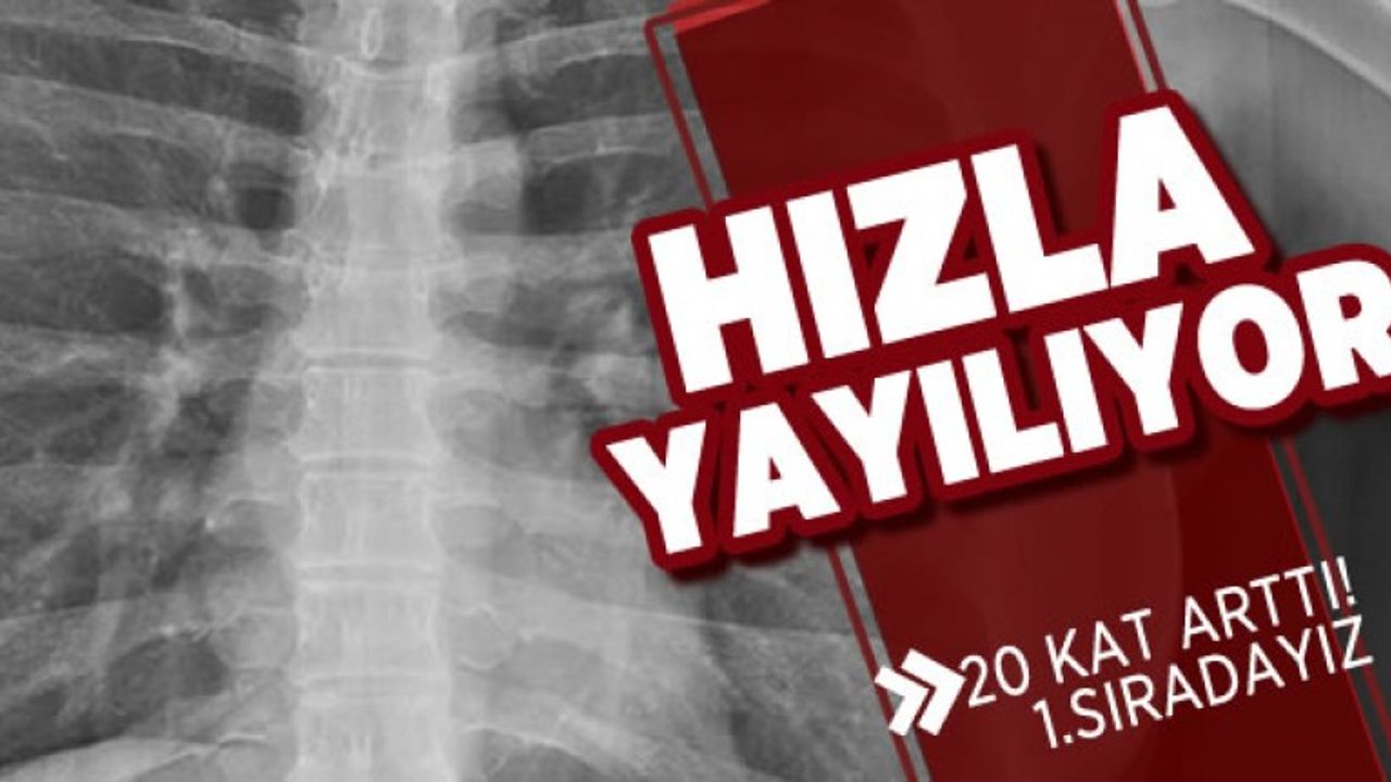 Kovid korkusu tomografiyi 20 kat artırdı