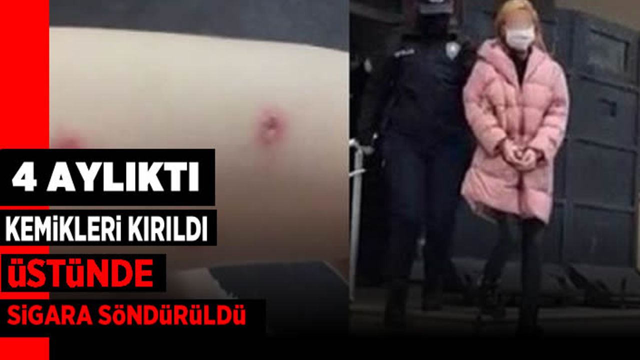 Henüz 4 aylıktı, kemikleri kırıldı, vücudunda sigara söndürüldü!