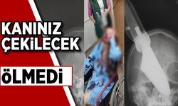 Burnunda 25 santimetrelik bıçakla hastaneye getirildi! Kan dondurdu