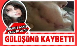Fransız askısıyla gülüşünü kaybetti