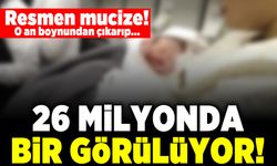 Resmen mucize! O an boynundan çıkarıp... 26 milyonda bir görülüyor!