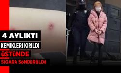 Henüz 4 aylıktı, kemikleri kırıldı, vücudunda sigara söndürüldü!