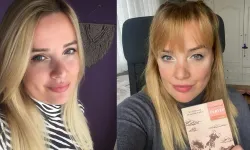 Ünlü Yazarın Estetik Kabusu! Dövme Sildirme İşlemi Kolundan Ediyordu