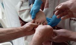 Kahramanmaraş'ta parmakta sıkışan yüzüğü itfaiye çıkardı