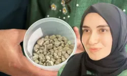İnanılmaz Olay: Vücudundaki 287 Taşla Yaşıyordu! Ameliyat Sonrası Doktorlar Gördüklerine İnanamadı
