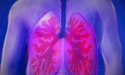 Kahramanmaraşlılar dikkat: Tedavisi zor hastalık olarak açıklandı!