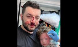 Servet Ergin kimdir, olayı nedir? İkra bebek ve babasına sopalı saldırı şoku!