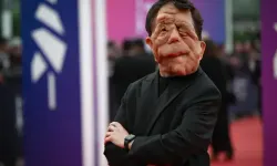 Adam Pearson Kimdir? Oscar 2026’ya Damga Vuran Oyuncunun Hayatı