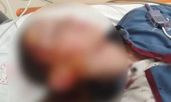Köpek Sahiplerine Dikey Uyarı: Emsal Tazminat Kararı Çıktı