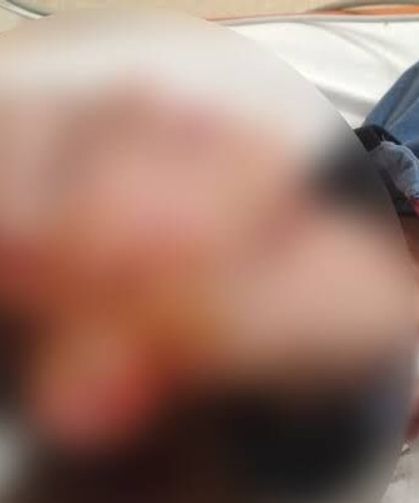 Köpek Sahiplerine Dikey Uyarı: Emsal Tazminat Kararı Çıktı