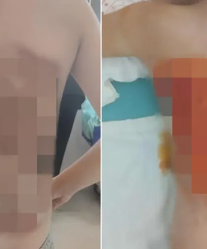 12 yaşındaki çocuğa akran zorbalığı: 25 gün hastanede kaldı