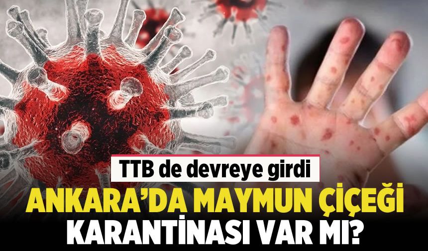 Türkiye’de Maymun çiçeği şüphesi: Karantina var mı, TTB neler söyledi?