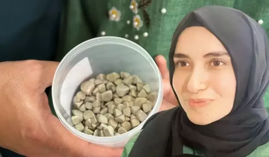 İnanılmaz Olay: Vücudundaki 287 Taşla Yaşıyordu! Ameliyat Sonrası Doktorlar Gördüklerine İnanamadı