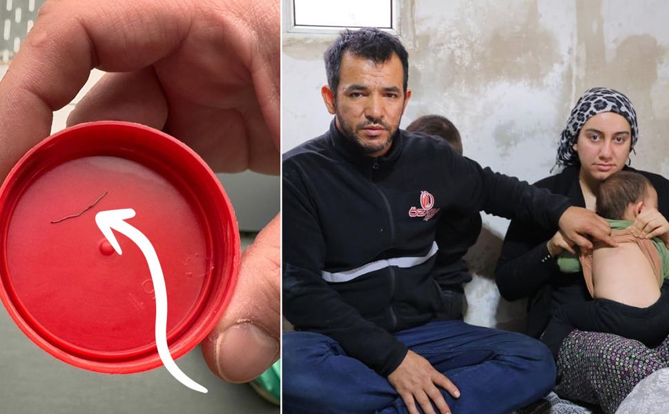 Kahramanmaraş'ta hastanede ihmal iddiası: Bebeğin belinden zımba teli çıktı!