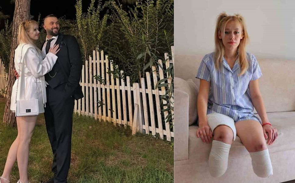 En mutlu gününde iki bacağını kaybetmişti! Kahramanmaraşlı İrem'i isyan ettiren son